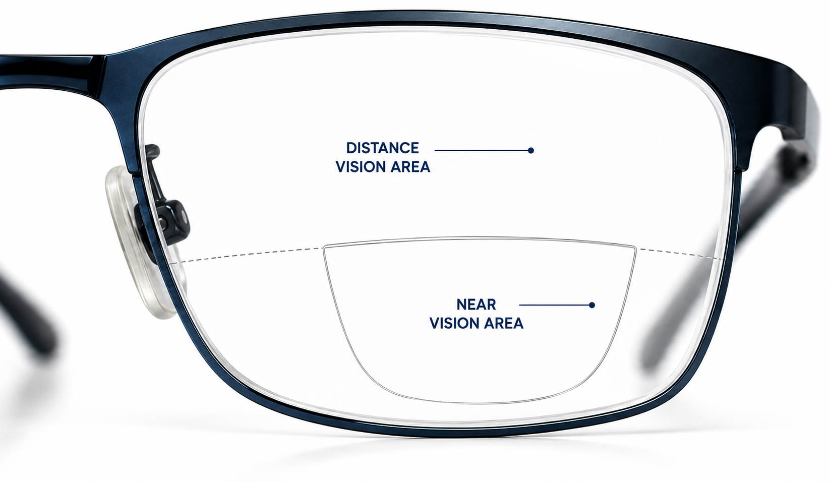 KBF Bifocal Lens